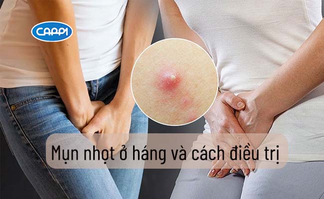 4. Khi nào nên gặp bác sĩ?